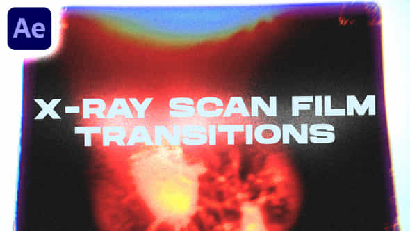 47852397-x-ray.jpg