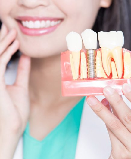 Dental Implants Marion