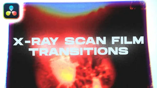 47852379-x-ray.jpg